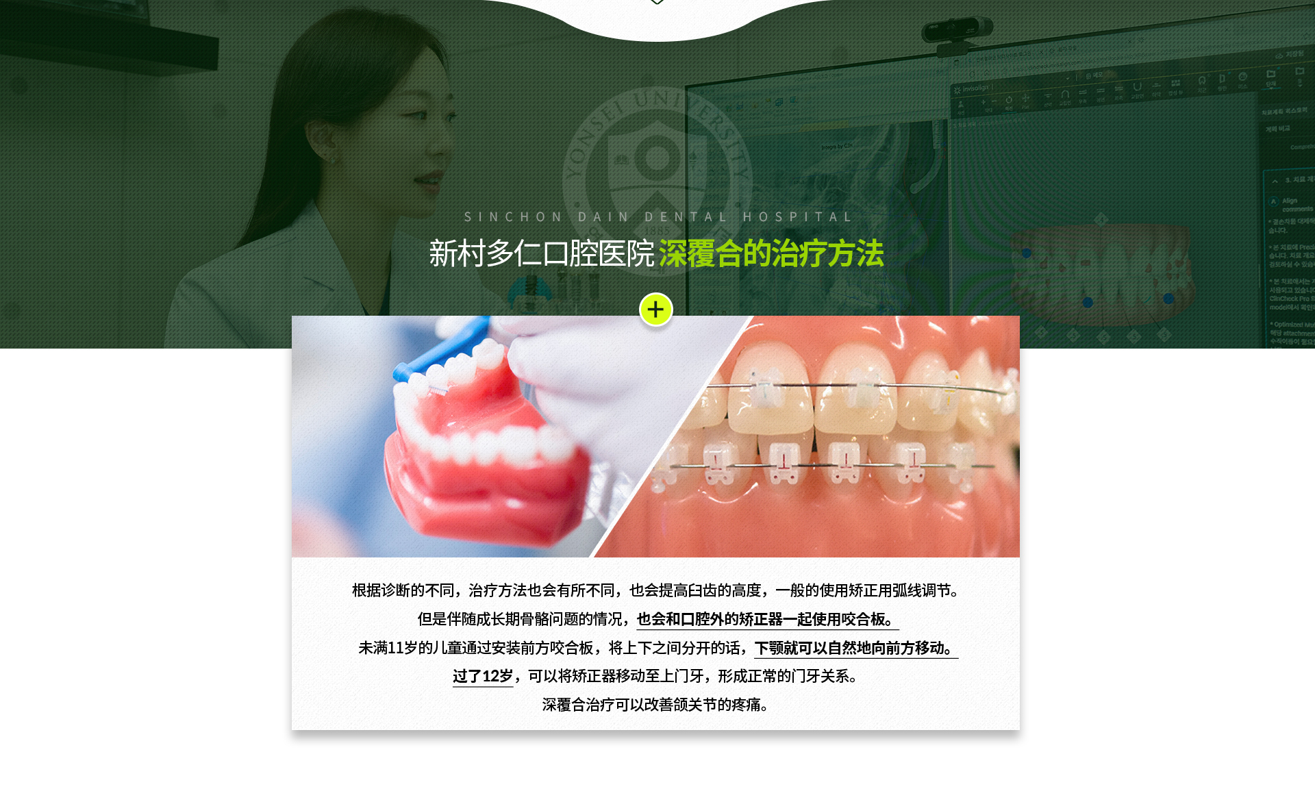 진단에-따라-치료법이-달라질-수-있으며-어금니의-높이를-높이기도-하며,-일반적인-교정용-호선으로-조절하기도-하지만-성장기-골격-문제를-동반하는-경우-구외-교정장치와-함께-교합-거상판을-사용,-11세-미만-어린이는-전방-교합-거상판-장착으로-위/아래-사이를-띄워주어-아래턱이-전방으로-자연스럽게-움직임,-12세-이후-교정장치로-위-앞니를-이동시켜-정상적인-앞니-관계를-형성
