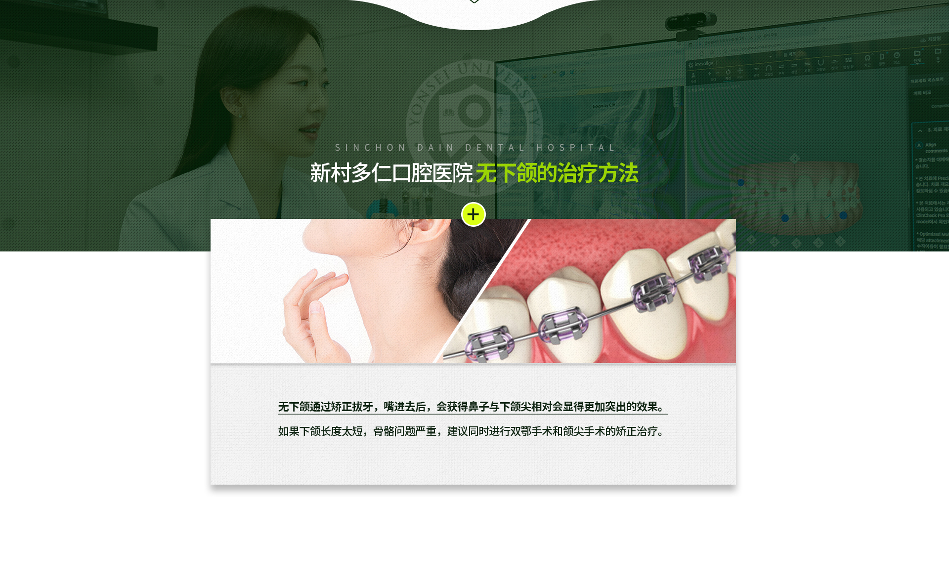 발치-교정을-통해-입이-들어가면서-상대적으로-코와-턱-끝이-살아나-보이는-효과를-얻을-수-있음-아래턱의-길이가-절대적으로-짧아-골격-문제가-심한-경우라면,-양악-수술과-턱-끝-수술을-동반한-교정-치료를-권함