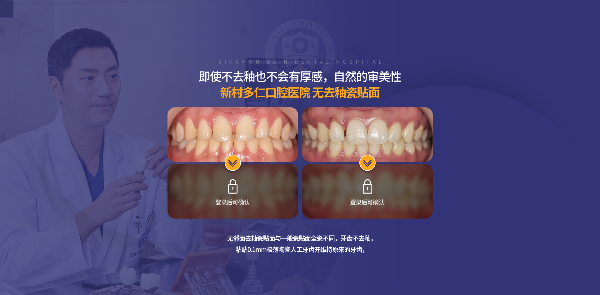 삭제-없이-부착해도-두꺼워진-느낌-없이-자연스러운-심미성-무삭제-라미네이트