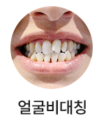 얼굴비대칭