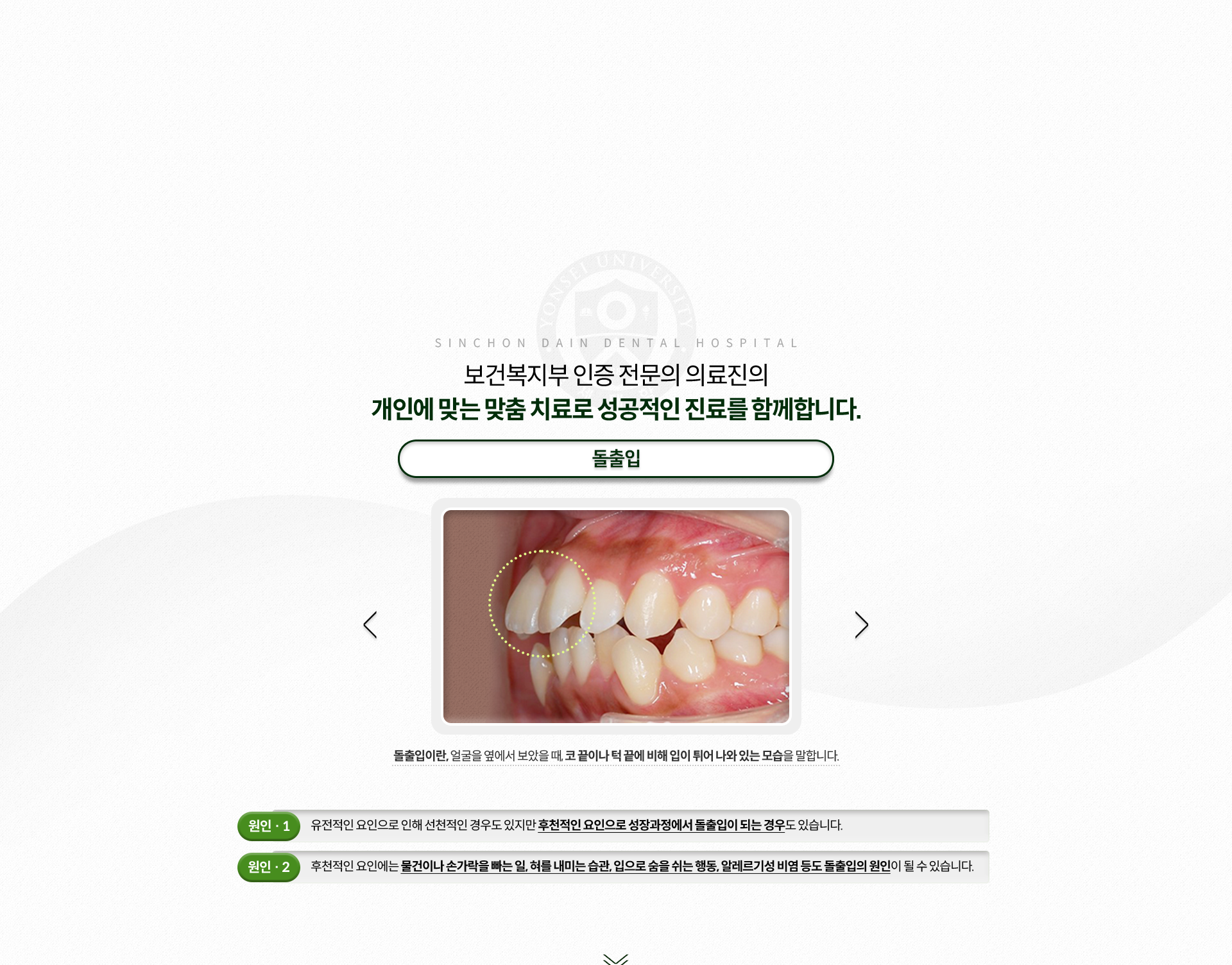 돌출입-얼굴을-옆에서-보았을-때,-코-끝이나-턱-끝에-비해-입이-튀어-나와-있는-모습-원인1-성장과정에서-돌출입이-되는-경우-원인2-물건이나-손가락을-빠는-일,-혀를-내미는-습관,-입으로-숨을-쉬는-행동,-알레르기성-비염-등