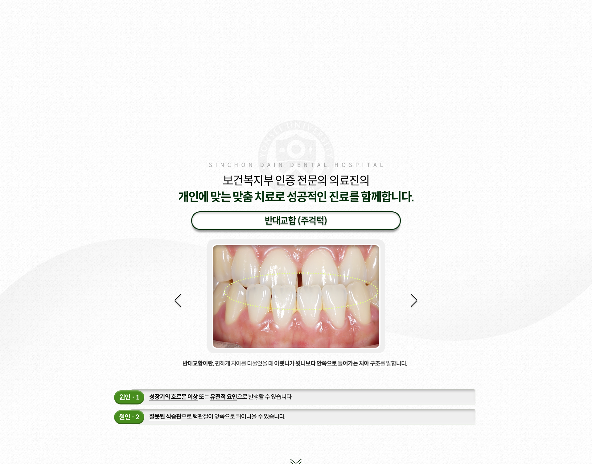 반대교합(주걱턱)-편하게-치아를-다물었을-때-아랫니가-윗니보다-안쪽으로-들어가는-치아-구조-원인1-성장기의-호르몬-이상-또는-유전적-요인-원인2-잘못된-식습관으로-턱관절이-앞쪽으로-튀어나옴