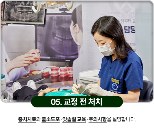 05)-교정-전-처치-충치치료와-불소도포,-잇솔질-교육,-주의사항을-설명합니다