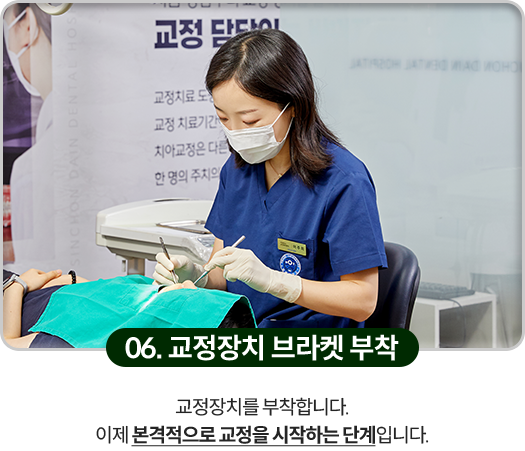 06)-교정장치-브라켓-부착-교정장치를-부착합니다-이제-본격적으로-교정을-시작하는-단계입니다