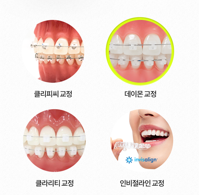 데이몬-교정
