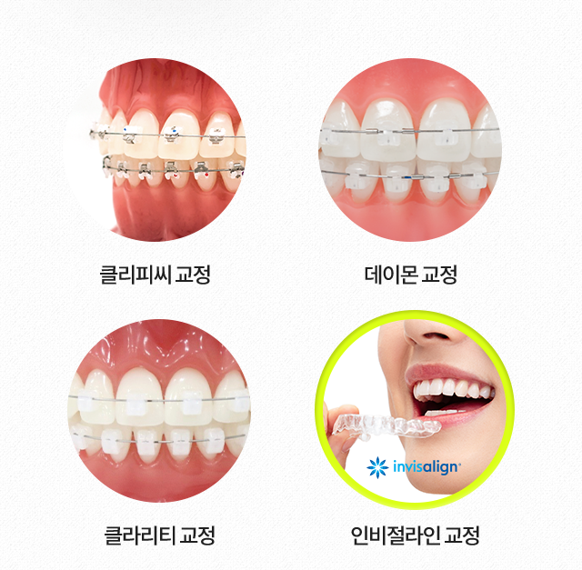 인비절라인-교정