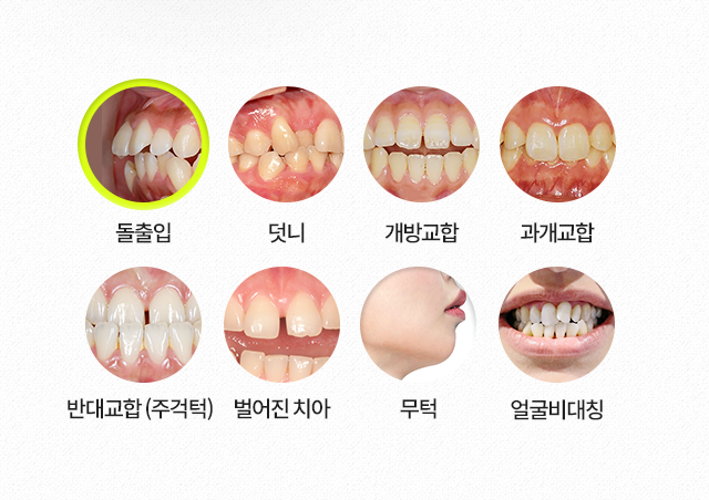 돌출입