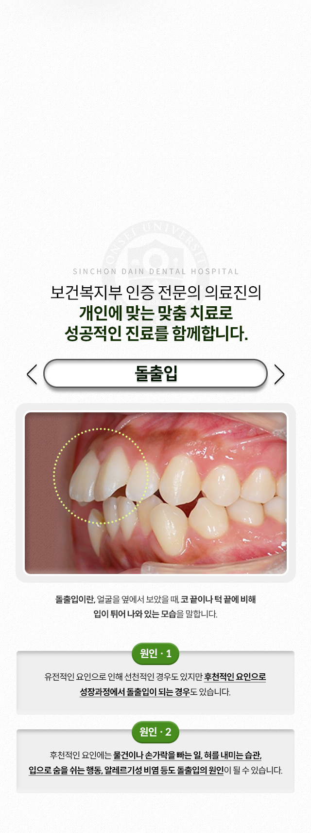 돌출입-얼굴을-옆에서-보았을-때,-코-끝이나-턱-끝에-비해-입이-튀어-나와-있는-모습-원인1-성장과정에서-돌출입이-되는-경우-원인2-물건이나-손가락을-빠는-일,-혀를-내미는-습관,-입으로-숨을-쉬는-행동,-알레르기성-비염-등