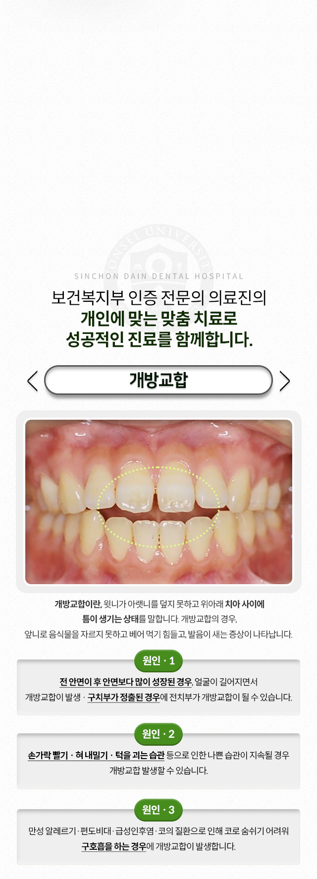 개방교합-윗니가-아랫니를-덮지-못하고-위아래-치아-사이에-틈이-생기는-상태-앞니로-음식물을-자르지-못하고-베어-먹기-힘들고-발음이-새는-증상-원인1-전-안면이-후-안면보다-많이-성장된-경우,-얼굴이-길어지면서-개방교합이-발생,-구치부가-정출된-경우에-전치부가-개방교합이-될-수-있음-원인2-손가락-빨기,-혀내밀기,-턱을-괴는-습관-원인3-만성-알레르기,-편도비대,-급성인후염,-코의-질환으로-인해-코로-숨쉬기-어려워-구호흡을-하는-경우