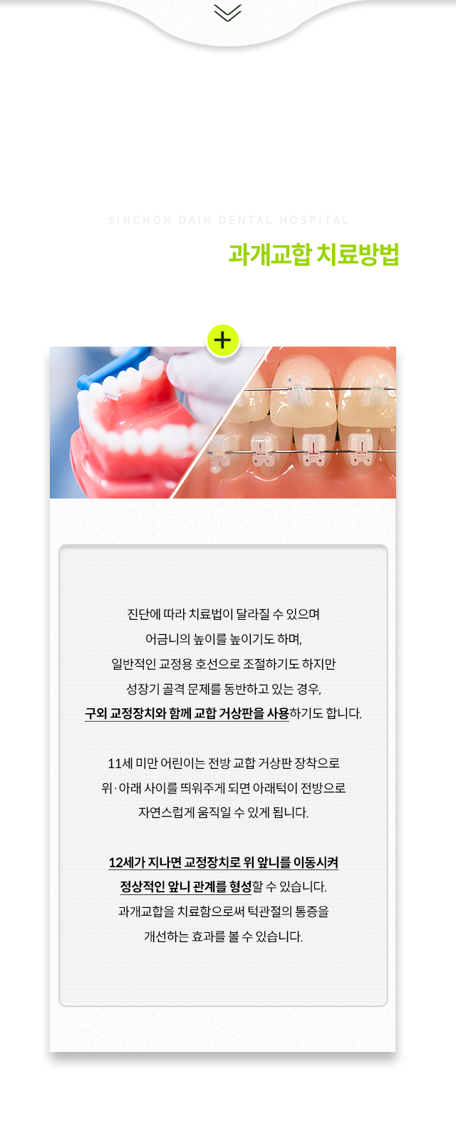 진단에-따라-치료법이-달라질-수-있으며-어금니의-높이를-높이기도-하며,-일반적인-교정용-호선으로-조절하기도-하지만-성장기-골격-문제를-동반하는-경우-구외-교정장치와-함께-교합-거상판을-사용,-11세-미만-어린이는-전방-교합-거상판-장착으로-위/아래-사이를-띄워주어-아래턱이-전방으로-자연스럽게-움직임,-12세-이후-교정장치로-위-앞니를-이동시켜-정상적인-앞니-관계를-형성