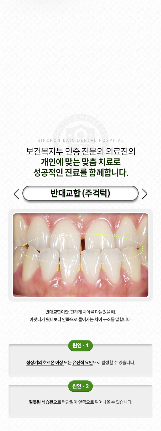 반대교합(주걱턱)-편하게-치아를-다물었을-때-아랫니가-윗니보다-안쪽으로-들어가는-치아-구조-원인1-성장기의-호르몬-이상-또는-유전적-요인-원인2-잘못된-식습관으로-턱관절이-앞쪽으로-튀어나옴