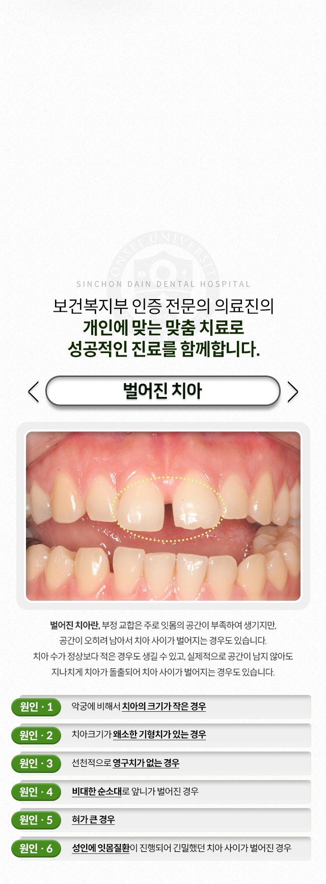 벌어진-치아-부정교합은-주로-잇몸의-공간이-부족하여-생기지만-공간이-오히려-남아서-치아-사이가-벌어지는-경우도-있음-치아-수가-정상보다-적은-경우도-생길-수-있고,-실제적으로-공간이-남지-않아도-치아가-지나치게-돌출되어-치아-사이가-벌어지는-경우도-있음-원인1-악궁에-비해-치아의-크기가-작은-경우-원인2-치아크기가-왜소한-기형치가-있는-경우-원인3-선천적으로-영구치가-없는-경우-원인4-비대한-순소대로-앞니가-벌어진-경우-원인5-혀가-큰-경우-원인6-성인에-잇몸질환이-진행되어-긴밀했던-치아-사이가-벌어진-경우