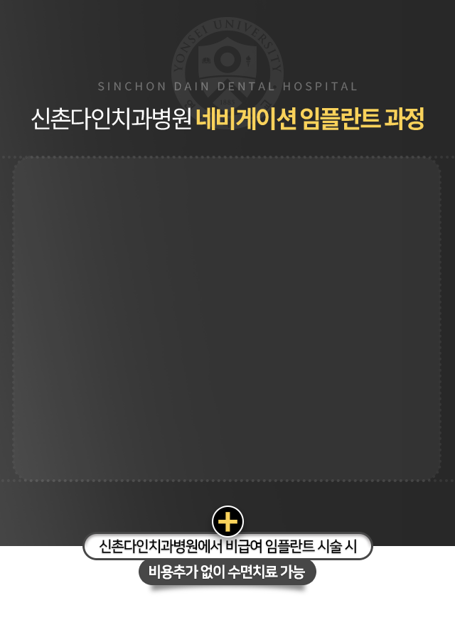 네비게이션-임플란트-과정