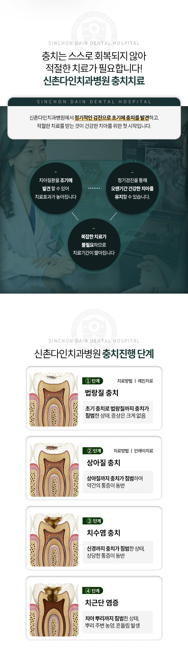 충치치료-충치는-스스로-회복되지-않아-적절한-치료가-필요합니다-정기적인-검진으로-초기에-충치를-발견하고,-적절한-치료를-받는-것이-건강한-치아를-위한-첫-시작입니다-치아질환을-조기에-발견-할-수-있어-치료효과가-높아집니다-복잡한-치료가-불필요하므로-치료기간이-짧아집니다-정기검진을-통해-오랜기간-건강한-치아를-유지할-수-있습니다-충치진행-1단계-법랑질충치-초기-충치로-법랑질까지-충치가-침범한-상태,-증상은-크게-없음-2단계-상아질-충치-상아질까지-충치가-침범하여-약간의-통증이-동반-3단계-치수염-충치-신경까지-충치가-침범한-상태,-상당한-통증이-동반-4단계-치근단-염증-치아-뿌리까지-침범한-상태,-뿌리-주변-농양/흔들림-발생