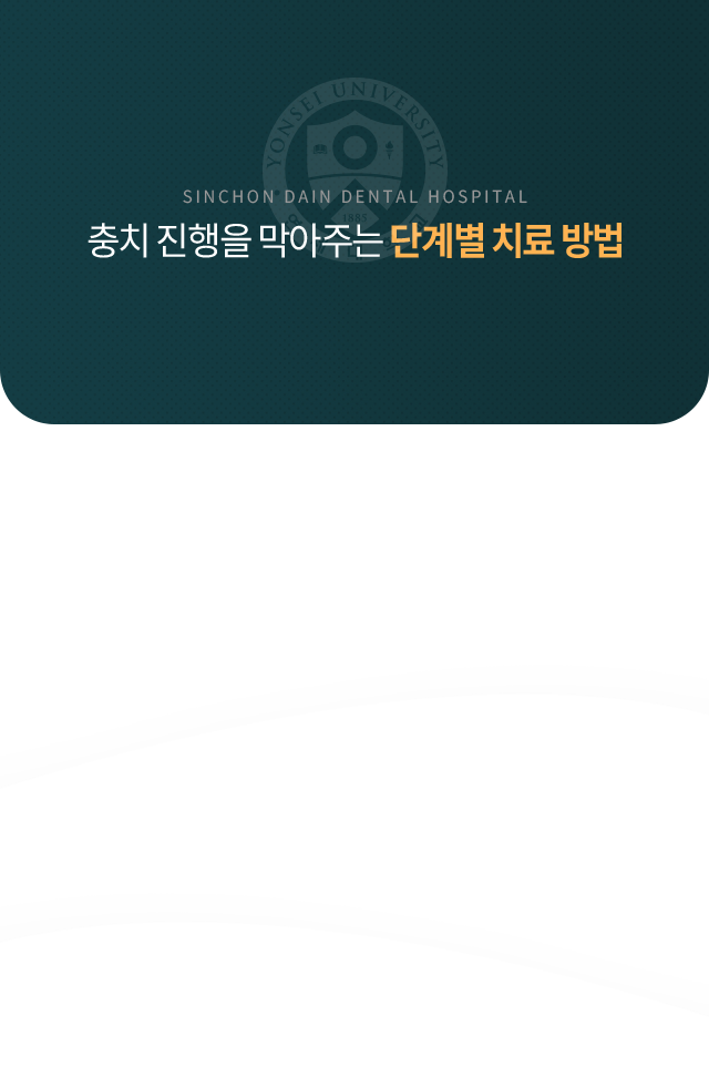 충치-진행을-막아주는-단계별-치료-방법