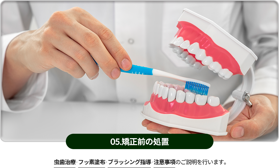 05)-교정-전-처치-충치치료와-불소도포,-잇솔질-교육,-주의사항을-설명합니다