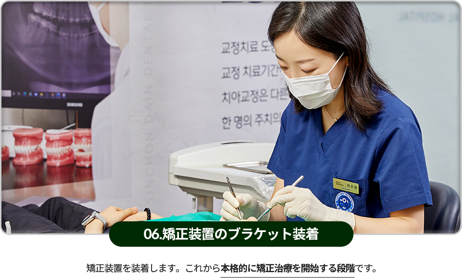 06)-교정장치-브라켓-부착-교정장치를-부착합니다-이제-본격적으로-교정을-시작하는-단계입니다