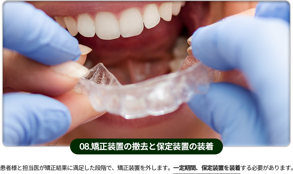 08)-교정장치-제거와-유지장치-장착-환자분과-담당-의사가-교정-결과에-만족하면-교정장치를-제거합니다-일정기간-동안-유지장치를-부착해야합니다