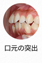 돌출입