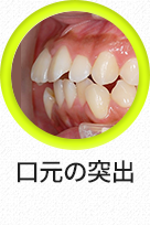 돌출입-선택됨