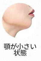 무턱