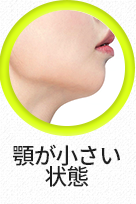 무턱-선택됨