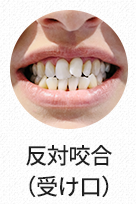 얼굴비대칭