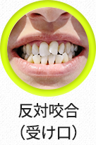 얼굴비대칭-선택됨