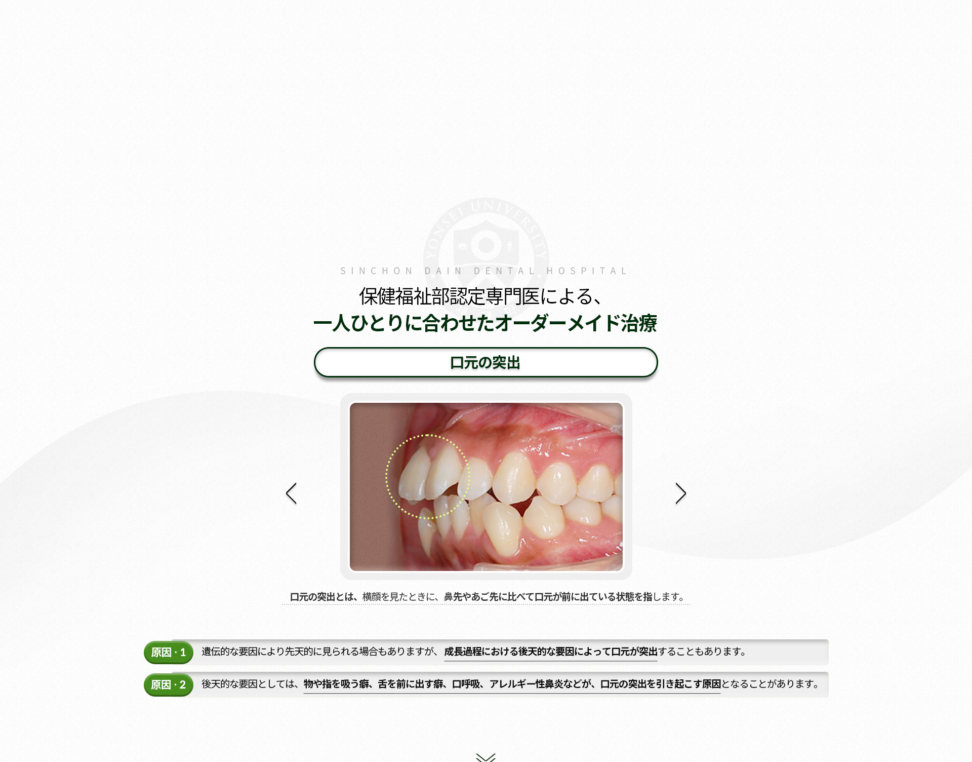 돌출입-얼굴을-옆에서-보았을-때,-코-끝이나-턱-끝에-비해-입이-튀어-나와-있는-모습-원인1-성장과정에서-돌출입이-되는-경우-원인2-물건이나-손가락을-빠는-일,-혀를-내미는-습관,-입으로-숨을-쉬는-행동,-알레르기성-비염-등