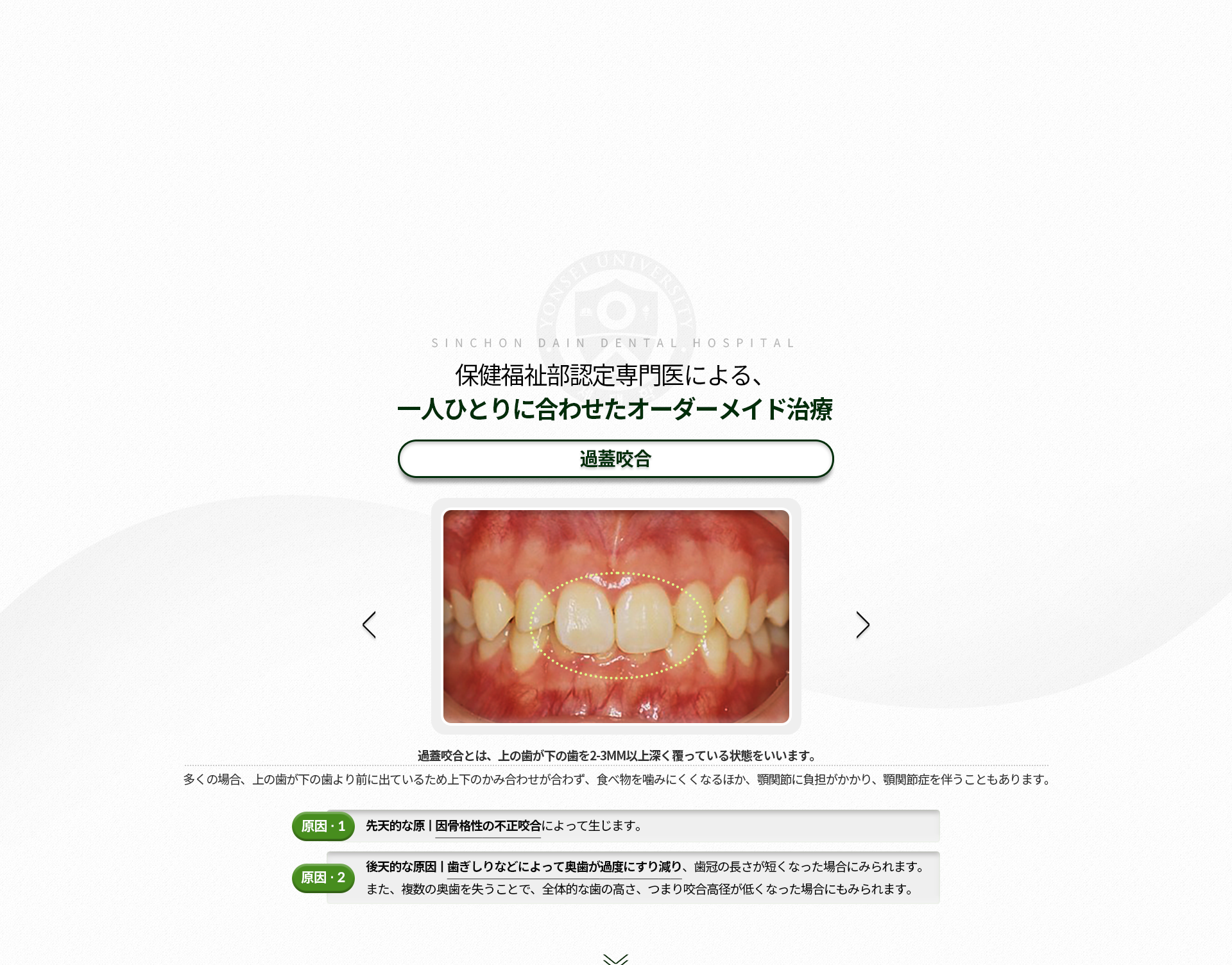 과개교합-윗니가-아랫니를-2~3mm이상-덮는-것-음식을-씹는-것도-힘들어-턱관절-장애가-있는-경우가-많음-원인1-선천적-원인-골격성-부정교합-원인2-후천적-원인-이갈이-등으로-인해-어금니-부위가-과도하게-마모되어-치관의-길이가-짧아진-경우,-여러-개의-어금니가-상실되어-전체적으로-치아의-높이,-즉-교합이-낮아진-경우