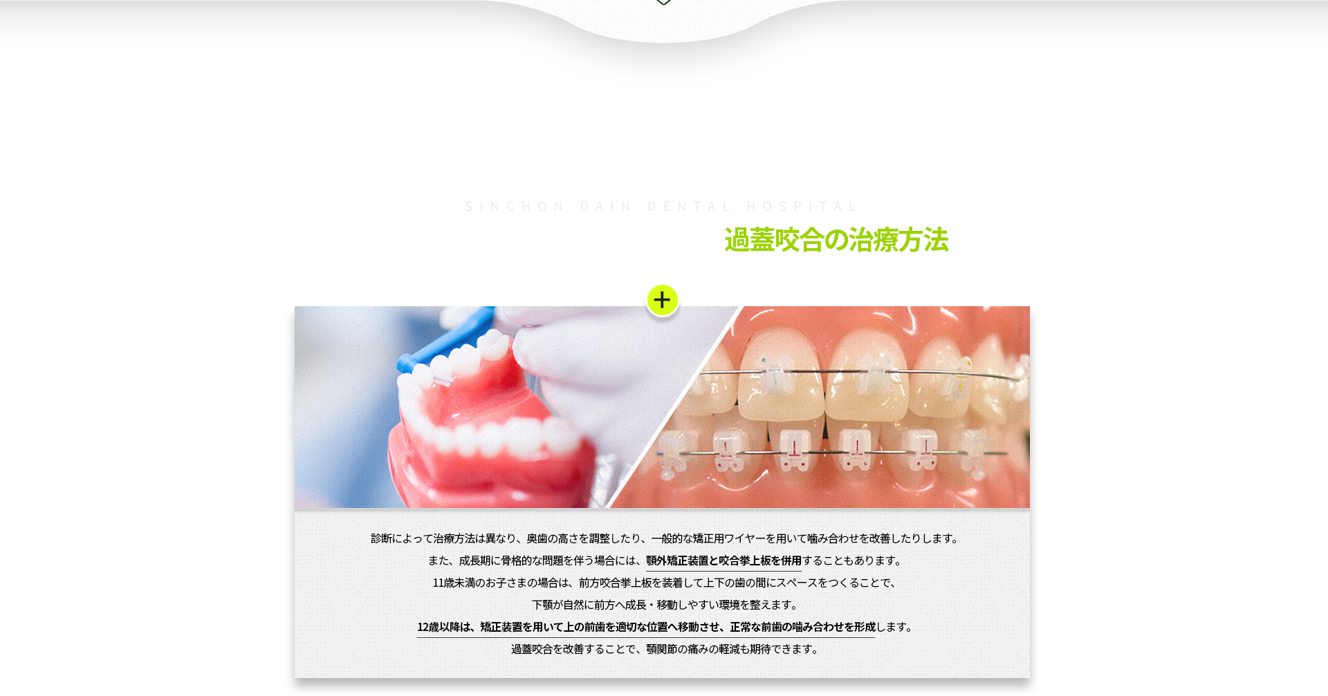 진단에-따라-치료법이-달라질-수-있으며-어금니의-높이를-높이기도-하며,-일반적인-교정용-호선으로-조절하기도-하지만-성장기-골격-문제를-동반하는-경우-구외-교정장치와-함께-교합-거상판을-사용,-11세-미만-어린이는-전방-교합-거상판-장착으로-위/아래-사이를-띄워주어-아래턱이-전방으로-자연스럽게-움직임,-12세-이후-교정장치로-위-앞니를-이동시켜-정상적인-앞니-관계를-형성