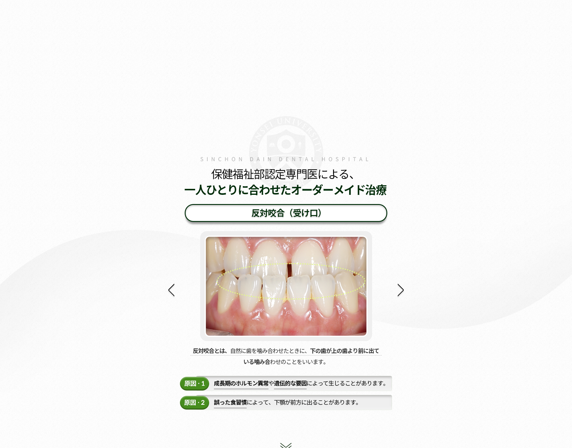반대교합(주걱턱)-편하게-치아를-다물었을-때-아랫니가-윗니보다-안쪽으로-들어가는-치아-구조-원인1-성장기의-호르몬-이상-또는-유전적-요인-원인2-잘못된-식습관으로-턱관절이-앞쪽으로-튀어나옴