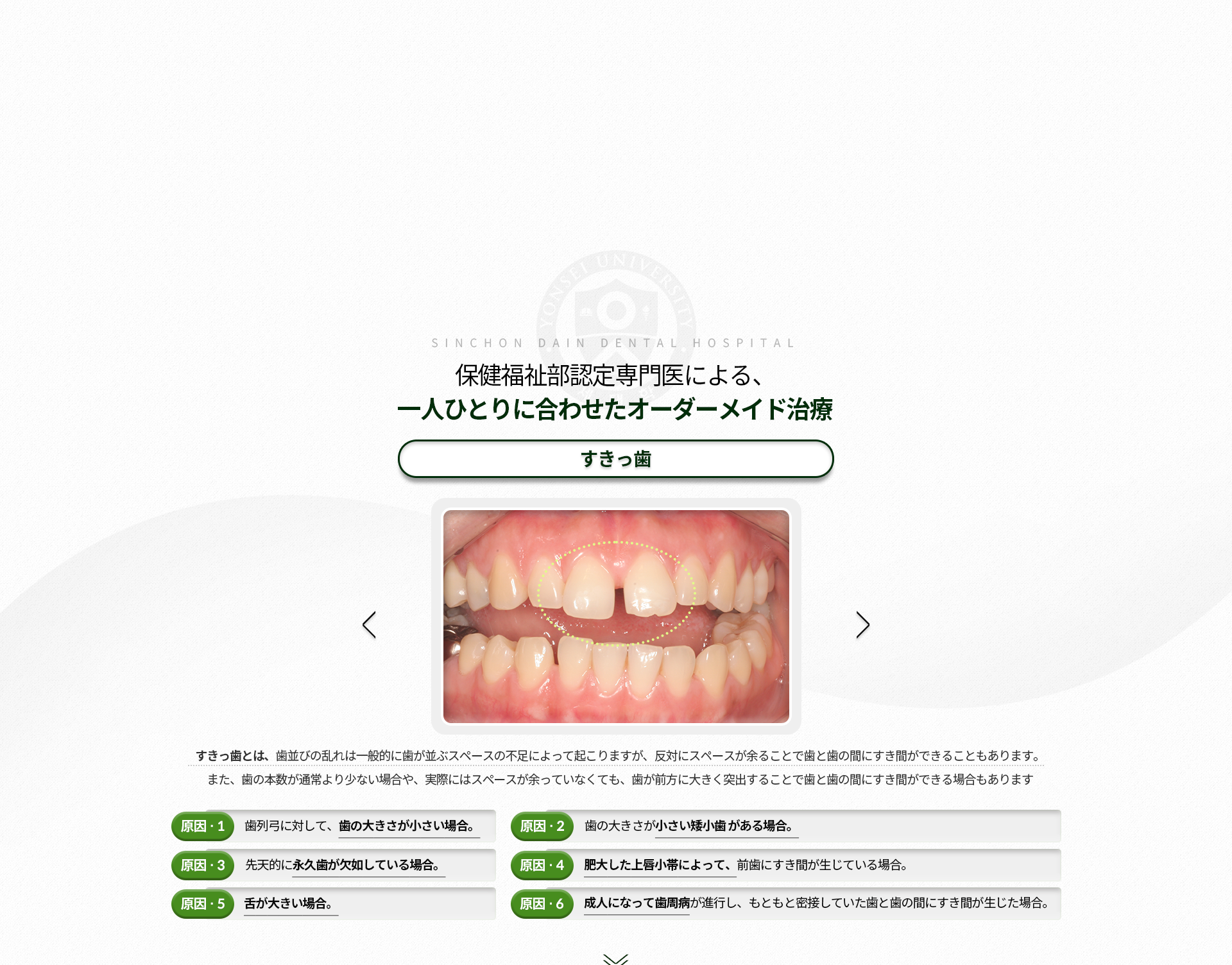 벌어진-치아-부정교합은-주로-잇몸의-공간이-부족하여-생기지만-공간이-오히려-남아서-치아-사이가-벌어지는-경우도-있음-치아-수가-정상보다-적은-경우도-생길-수-있고,-실제적으로-공간이-남지-않아도-치아가-지나치게-돌출되어-치아-사이가-벌어지는-경우도-있음-원인1-악궁에-비해-치아의-크기가-작은-경우-원인2-치아크기가-왜소한-기형치가-있는-경우-원인3-선천적으로-영구치가-없는-경우-원인4-비대한-순소대로-앞니가-벌어진-경우-원인5-혀가-큰-경우-원인6-성인에-잇몸질환이-진행되어-긴밀했던-치아-사이가-벌어진-경우
