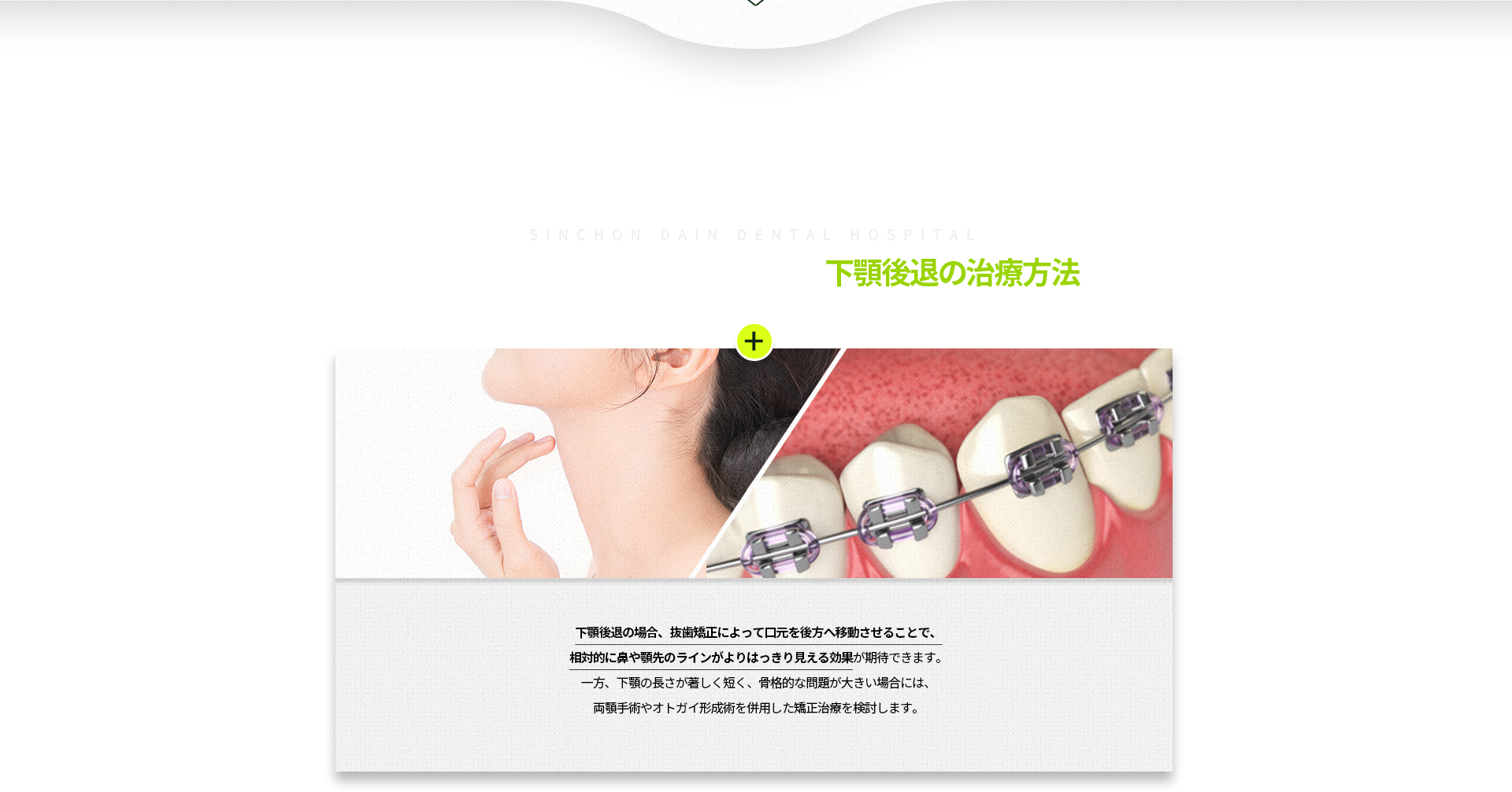 발치-교정을-통해-입이-들어가면서-상대적으로-코와-턱-끝이-살아나-보이는-효과를-얻을-수-있음-아래턱의-길이가-절대적으로-짧아-골격-문제가-심한-경우라면,-양악-수술과-턱-끝-수술을-동반한-교정-치료를-권함