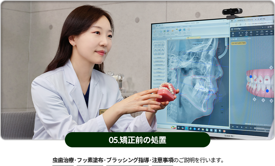 05)-교정-전-처치-충치치료와-불소도포,-잇솔질-교육,-주의사항을-설명합니다