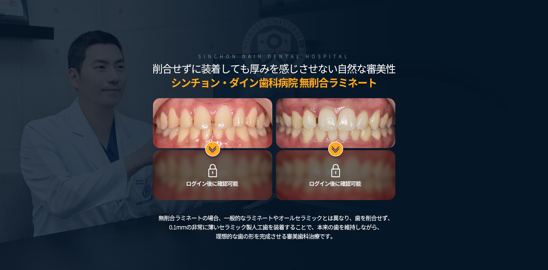 삭제-없이-부착해도-두꺼워진-느낌-없이-자연스러운-심미성-무삭제-라미네이트