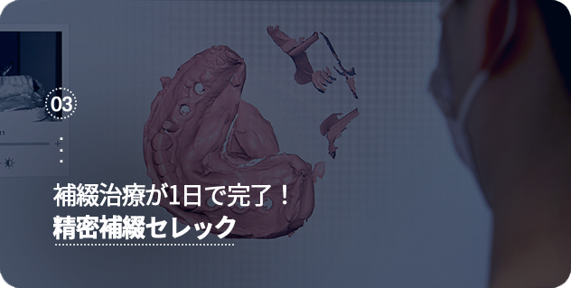 하루만에-보철치료-끝!-정밀보철세렉